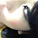achi