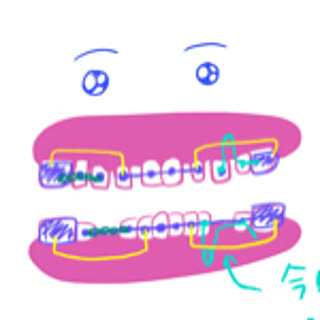 NZM