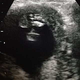 エコー写真のインテリア実例 Roomclip ルームクリップ